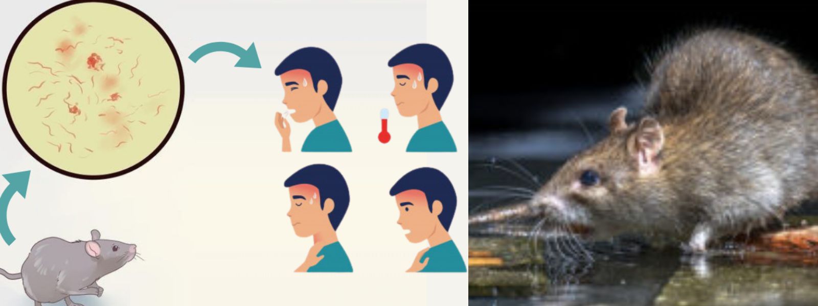 Health Departments Warn of Rat Fever Risk